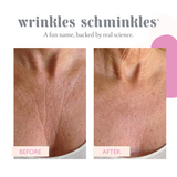 CHEST WRINKLE PATCH