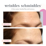 FOREHEAD WRINKLE PATCHES - 2 PATCHES