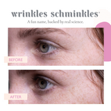 EYE WRINKLE PATCHES - 3 PAIRS