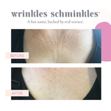 CHEST WRINKLE PATCH