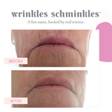 MOUTH & LIP WRINKLE PATCHES - 2 PATCHES