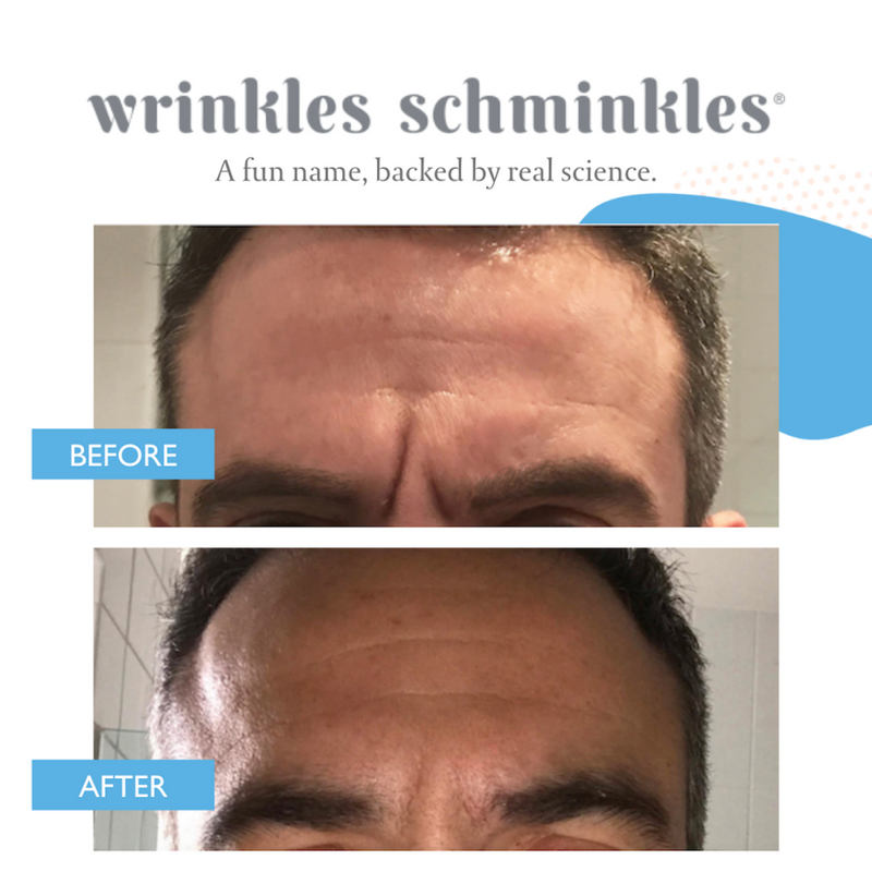 MEN'S FOREHEAD WRINKLE PATCHES - 2 PATCHES