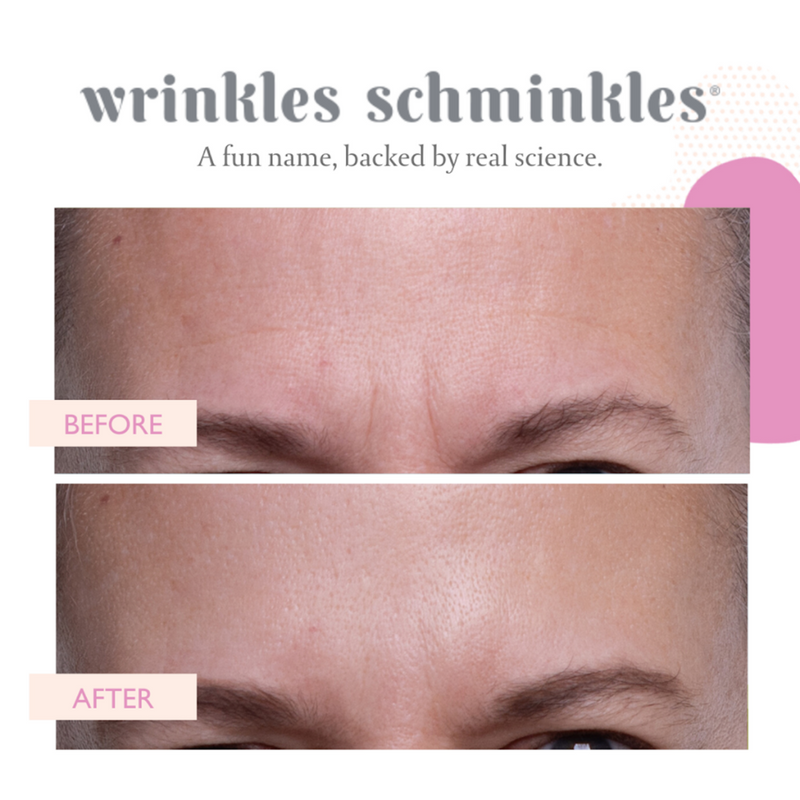 FOREHEAD WRINKLE PATCHES - 2 PATCHES