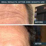 MEN'S FOREHEAD WRINKLE PATCHES - 2 PATCHES