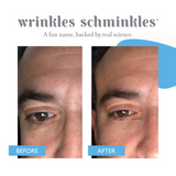 MEN'S EYE WRINKLE PATCHES - 3 PAIRS