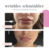 MOUTH & LIP WRINKLE PATCHES - 2 PATCHES